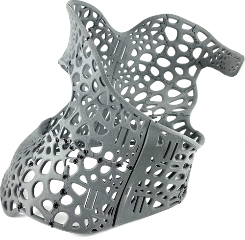 3D printed scoliosis brace