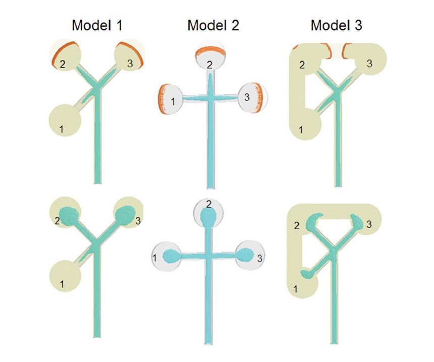 cavity design model