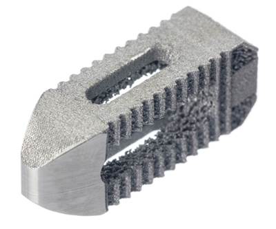 Advanced Material in Additive Manufacturing Produces Better Spinal Implant