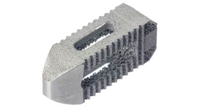 Additive Manufacturing Process Using Titanium Alloy Builds More Stable Spinal Implant