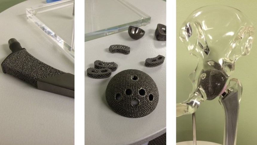 Additively manufactured hip implants