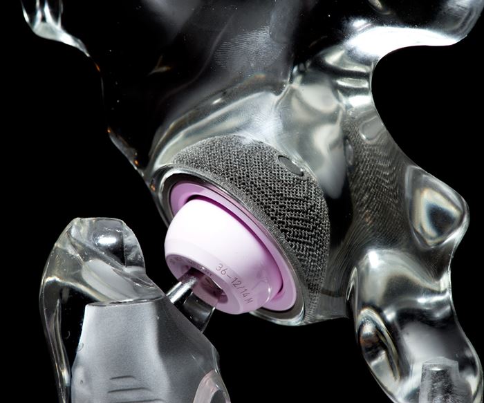 3D-printed hip implant, Additive Manufacturing Magazine
