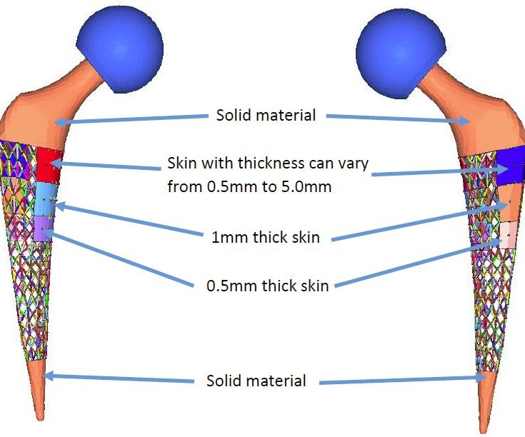Edge Loading How Topology Optimization Could Be the Key to Longer-Lasting Hip ...