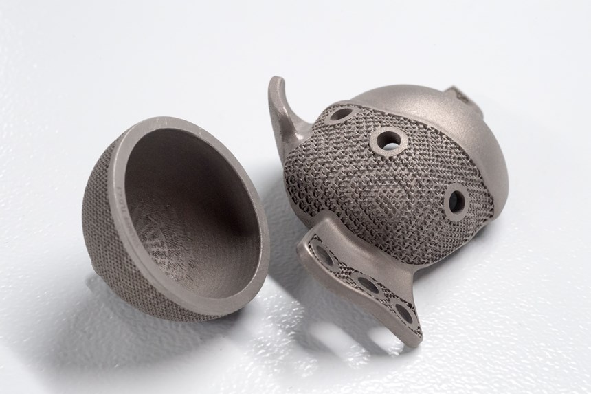 3D printed medical implants