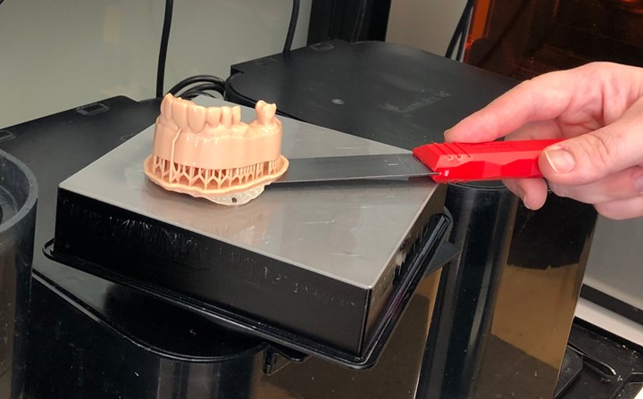 3D printed dental model