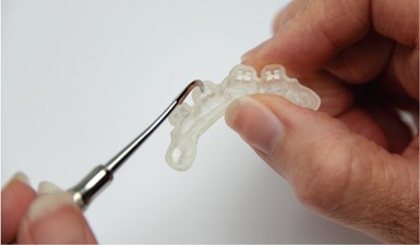 LightForce’s 3D-printed brackets improve the orthodontic experience for both patients and doctors.