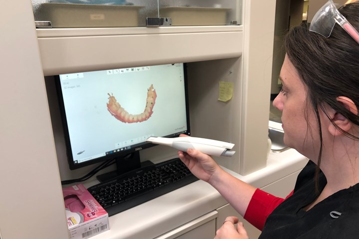 intraoral scanner showing image on screen