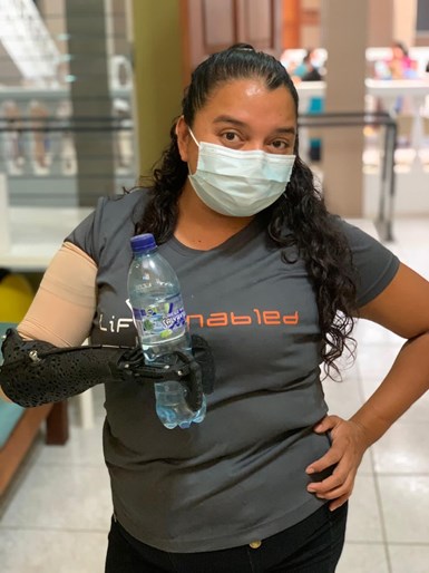 woman holding a water bottle with a 3d printed arm prosthesis