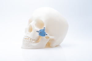 3D-Printed Ceramics for MedTech: Multifeature Disruption