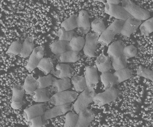 E. coli bacteria destroyed by the anti-bacterial coating made from zinc oxide nanopillars.