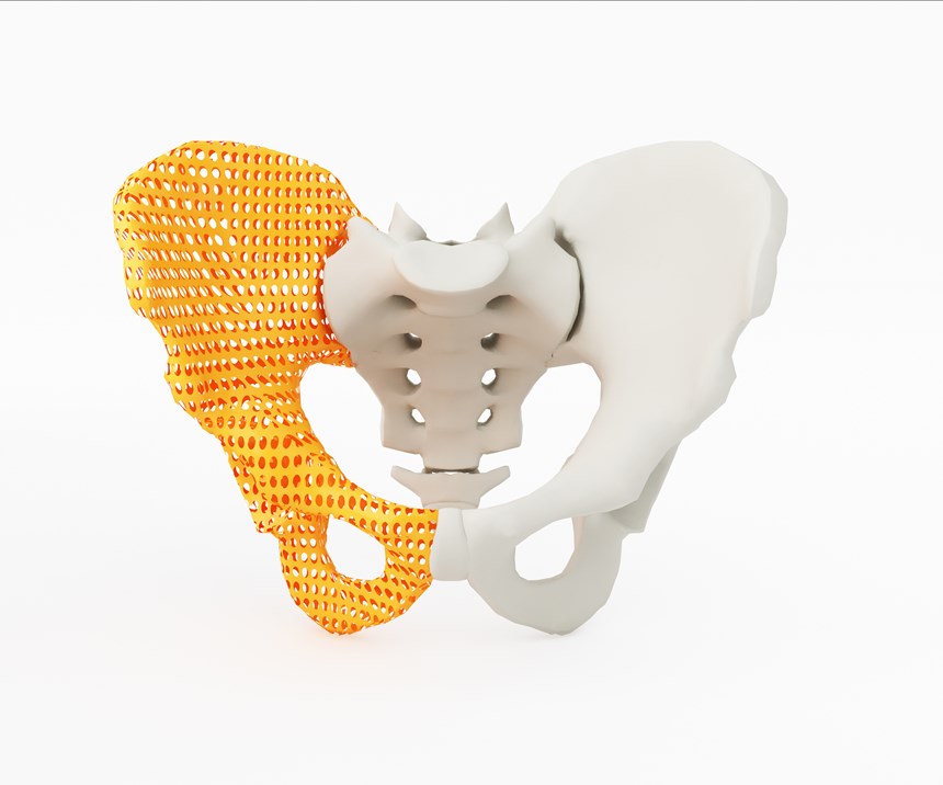 hip bone in 3D