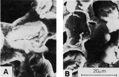Figure 13 - SEM micrographs showing voids in nickel deposits  created by the dislodgement of 20- to 40-µm synthetic diamond particles: (a) deposit at 1 A/dm2 on a vertical cathode and (b)  deposit at 1 A/dm2 on a horizontal surface.