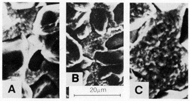 Figure 6 - SEM surface views of deposits produced at 4 A/dm2 in  nickel sulfamate solution (at 50°C) containing 125 carat/L of 15- to 30-µm natural diamonds using: (a) a horizontal cathode and mag- netic stirrer at 180 rpm, (b) a horizontal cathode and magnetic  stirrer at 360 rpm, and (c) a vertical cathode and magnetic stirrer at 180 rpm.
