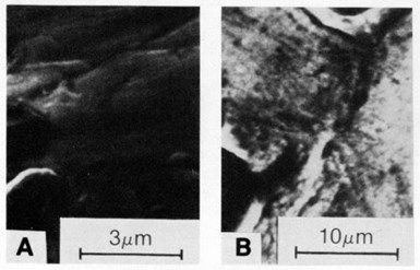 Figure 8 - SEM micrographs of deposit surfaces formed in nickel sulfamate bath (at 50°C) containing 25 carat/L of synthetic diamond particles: (a) 4 A/dm2, 3- to 6-µm particles and (b) 3 A/dm2, 20- to 40-µm particles.