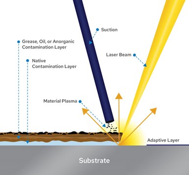 how laser ablation works