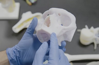 Anatomic 3D printed models enable medical staff to practice and plan for surgeries. Photo Credit: Stratasys