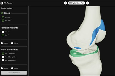 Surgeons can view patient-specific 3D models and comment on implant and guide placement at their convenience using VSP Connect to help streamline preoperative planning. Photo Credit: 3D Systems