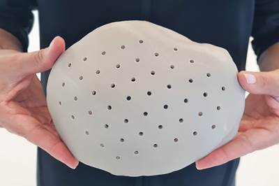 3D Systems Receives FDA Clearance for World’s First 3D Printed PEEK Cranial Implants