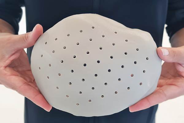 3D Systems Receives FDA Clearance for World’s First 3D Printed PEEK Cranial Implants, and More News of Note