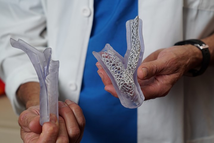  3D printed anatomic model