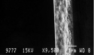 Figure Scanning-electron micrograph image